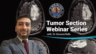 Preoperative Brain Mapping & Neuromodulation of Brain Tumors in Eloquent Areas - Dr. Giovanni Raffa