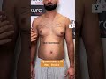 Sculpt a Masculine Chest with Dr. Vikas Gawri’s Expert Gynecomastia Surgery at Kyra Clinic 🔥