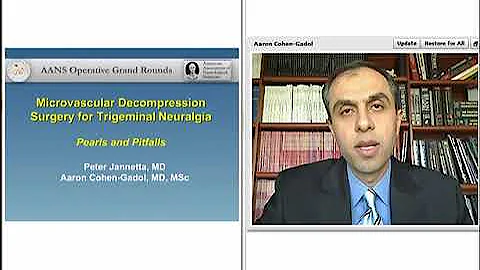 Microvascular Decompression Surgery for Trigeminal Neuralgia (Preview)