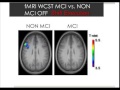 Parkinson canada webinar  april 2012