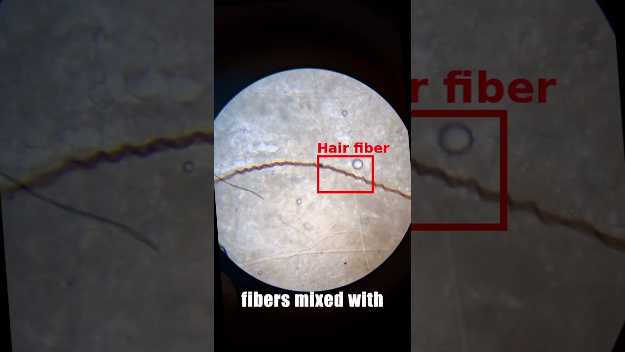 What’s Hiding Inside Your Earbuds? 🔬🪱 Microscope Reveal