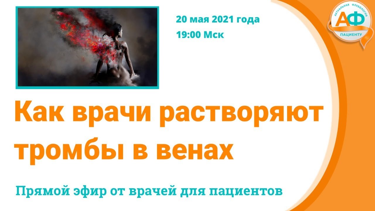 Как врачи растворяют тромбы в венах - YouTube