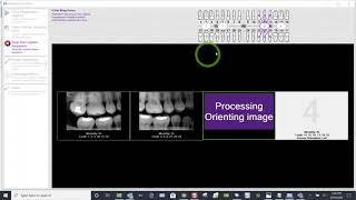 Training:  Apteryx XVWeb 2.0 - How to Acquire 4 BWXs in XVCapture