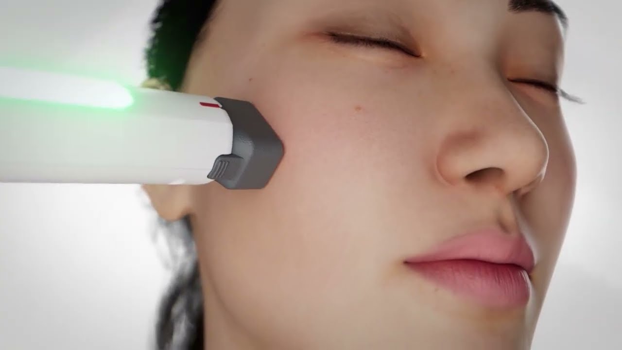 XERF x EVE Aesthetics Collab - Cynosure Lutronic - Future of Non-surgical Facelift 