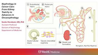 9-17-2026 - Nephrology in Cancer Care: From Kidney Toxicity to Advances in Onconephrology