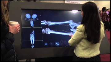 Sectra Visualization Table Demo From IMSH 2014 | HealthySimulation.com