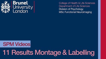 SPM Tutorial 11 - Montage and Labelling