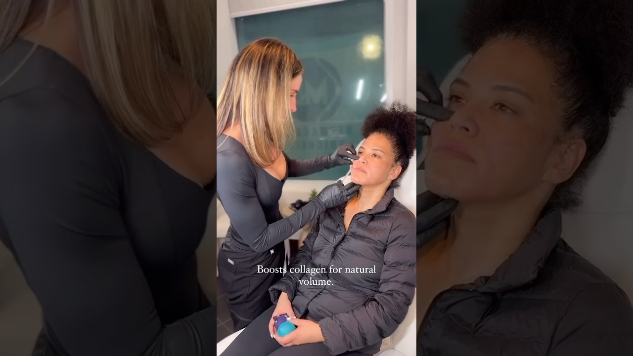 What Is Sculptra? The Secret to Youthful Skin | Dermacare Brickell Miami 