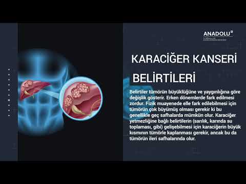 Karaciğer Kanseri Nedir?