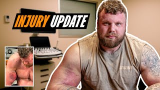 Download Lagu Tom Stoltman Injury UPDATE – What’s Next for World's Strongest Man? MP3 Download Lagu Tom Stoltman Injury UPDATE – What’s Next for World's Strongest Man? MP3