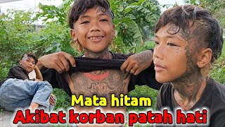 BOCAH KOCAK || MATA HITAM AKIBAT KORBAN PATAH HATI screenshot 3