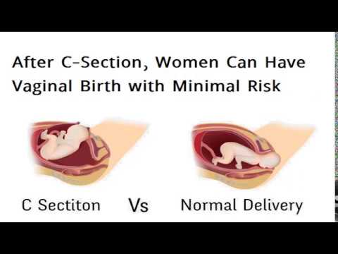 Intention for cesarean section versus vaginal delivery among pregnant women in isfahan