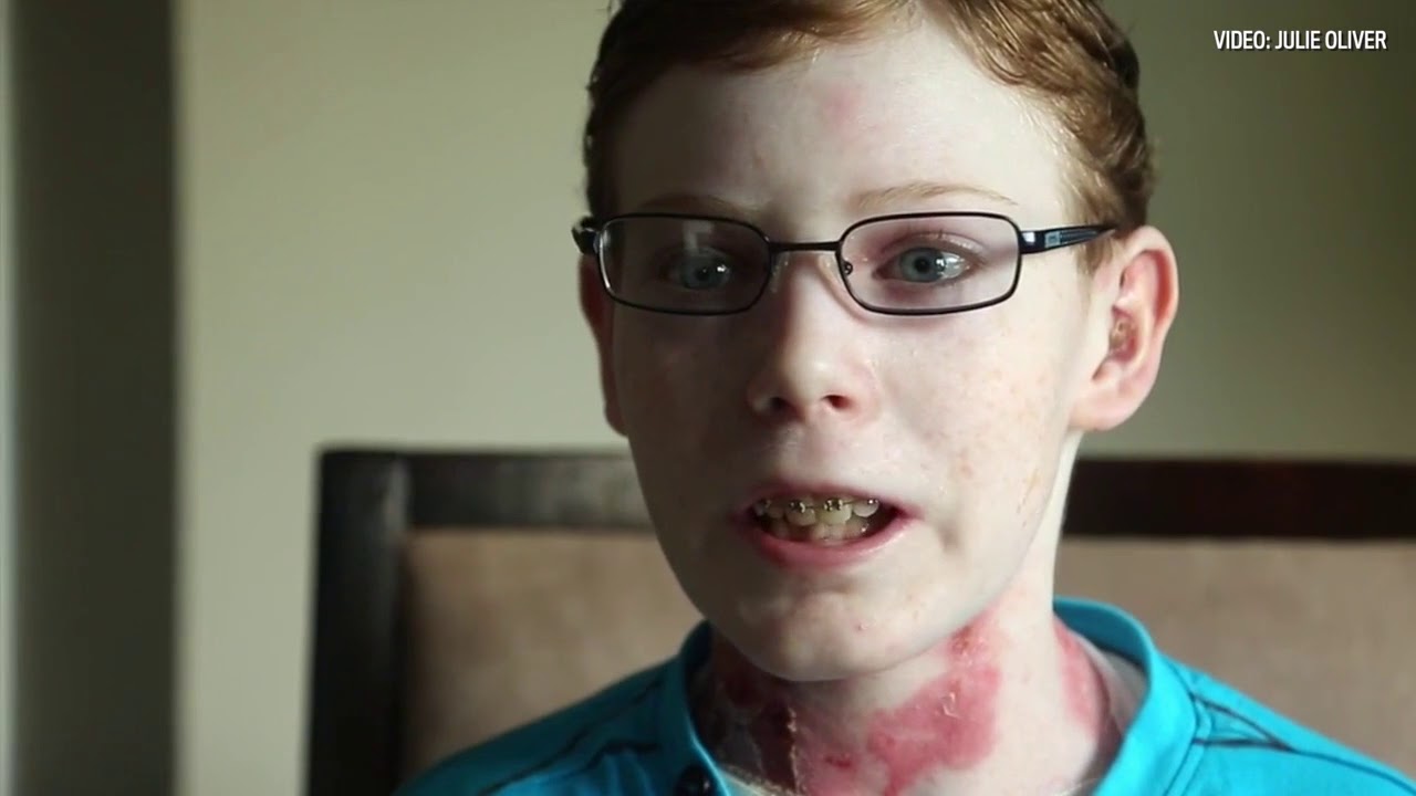 Pitre: A reporter reflects