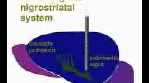 Nigrostriatal lesions provide an animal model of Parkinson