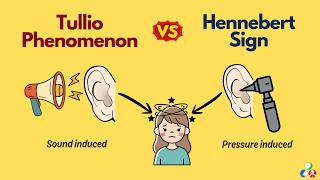 Tullio Phenomenon vs Hennebert Sign | Sound vs Pressure Induced Vertigo