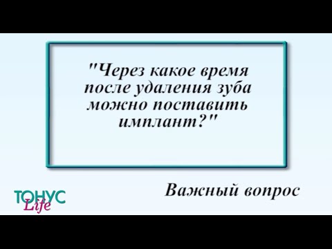 Через какое время после удаления зуба можно поставить имплант?