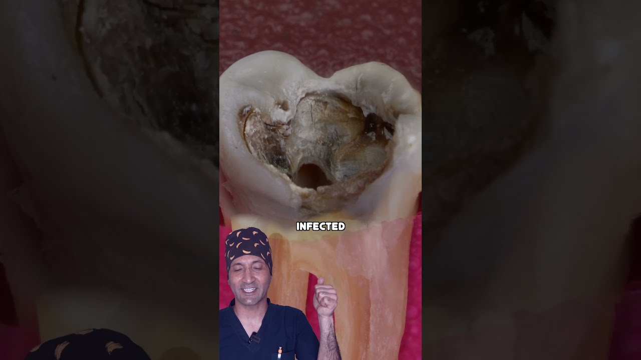 Amazing Dentist Explains Root Canal Satisfying