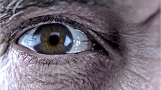 Solar eclipse 2017: A warning about viewing without eye protection