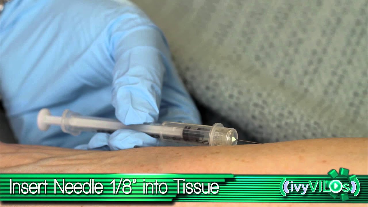 Intradermal Injection: Upper Forearm ~ivyVILOs~(Ivy Tech Community ...