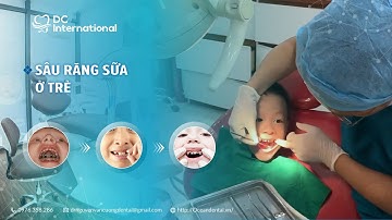 Sâu răng sữa ở trẻ! Điều trị tủy ở trẻ em Dr Cường