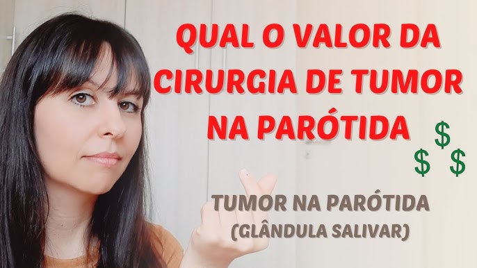 O que pode ser um Caroço na Lingua? - Dr. Thiago Chulam