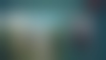 Laparoscopic Revision of Gastric band to Roux en Y gastric bypass - Jaideepraj Rao