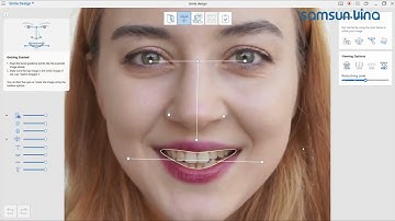 [SAMSUN VINA] Có Gì Trong Ứng Dụng Medit Smile Design v1.2