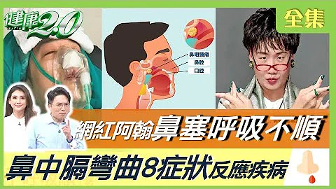 网红阿翰鼻塞呼吸不顺 动鼻中膈手术！小心鼻中膈弯曲8症状 鼻涕颜色反应疾病 急性鼻窦炎恐失明！长期嘴破恐口腔癌 健康2.0 20221203【完整版】江坤俊 韦汝 吴昭宽 柳朋驰 吴明珠 小彤 王明勇 - 天天要闻