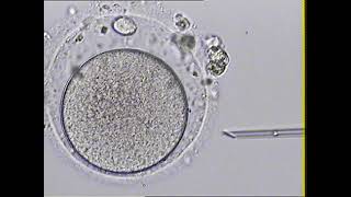 ICSI Video 11
