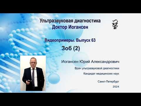 Ультразвуковая диагностика (УЗИ). Доктор Иогансен. Видеопримеры. Выпуск 63. Зоб (2).
