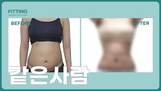 피팅의원 복부 지방흡입 Before &amp; After