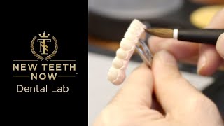 On-Site Dental Lab and Restorative Doctors | New Teeth Now