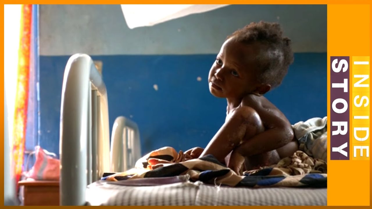 🇨🇩 من سينقذ أطفال جمهورية الكونغو الديمقراطية من المجاعة؟ | قصة من الداخل