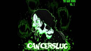Watch Cancerslug All You Need video