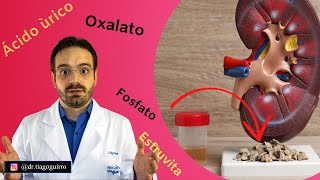 You Need to Know What Type of Kidney Stone You Have! You Need to Know What Type of Kidney Stone You Have!