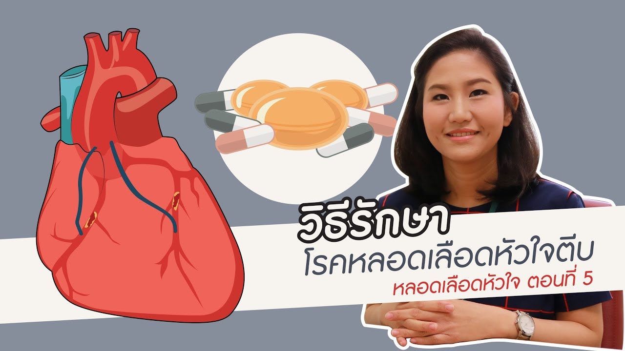 โรคประสาท หัวใจ  New 2022  หลอดเลือดหัวใจ ตอนที่ 5: วิธีรักษาโรคหลอดเลือดหัวใจตีบ