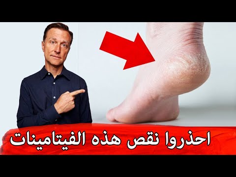 فيديو: هل يحتوي الكريوليت على الفلور؟