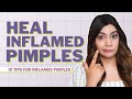 How to Treat and Heal Inflamed Pimples