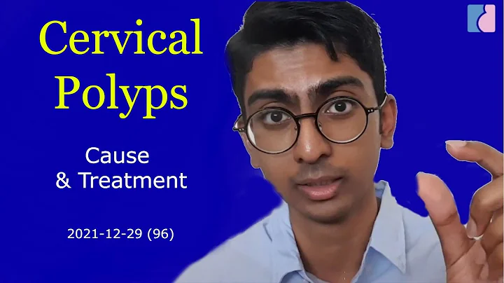 Polypes cervicaux: causes, symptômes et traitements