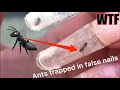 Ants In Nails 