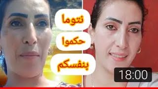 كريم لهناني من الكلف وتصبغات البشرة