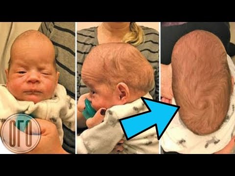 После Рождения Этих Тройняшек, ВРАЧИ ПОНЯЛИ, ЧТО с НИМИ ЧТО-ТО НЕ ТАК!