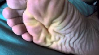 Wrinkled Soles Upclose