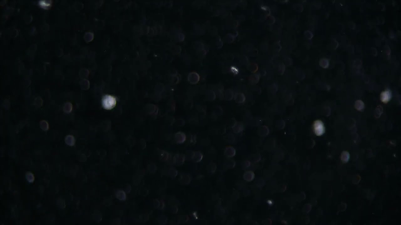 инфузория Халтерия(Halteria)