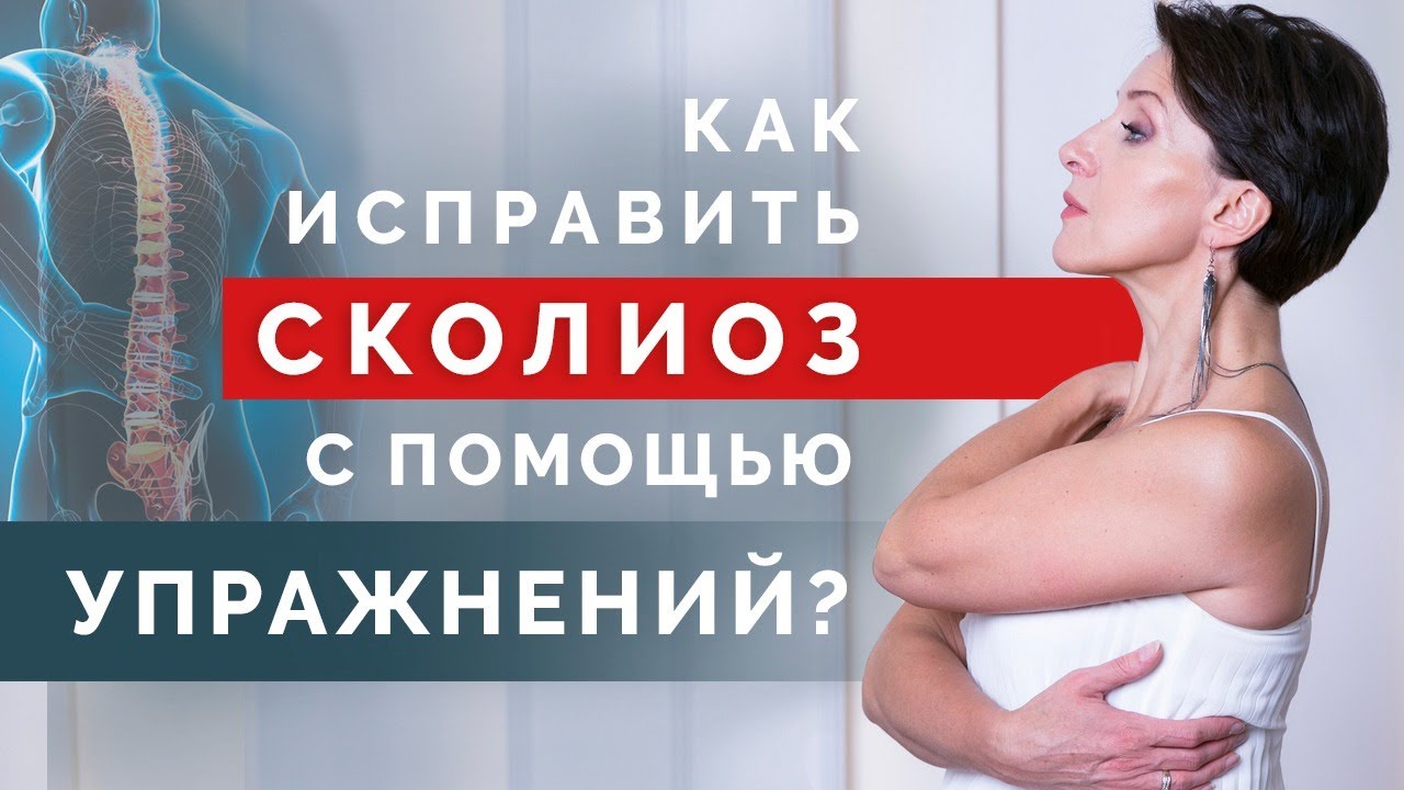 Как вылечить сколиоз с помощью упражнений? Простые упражнения для ...