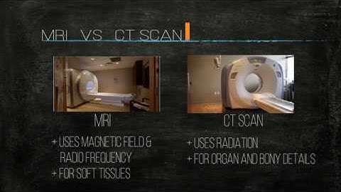 Image Reconstruction in MRI