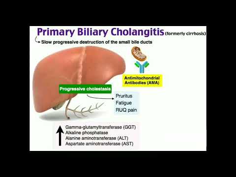 Vídeo: Cirrosi biliar primària del fetge