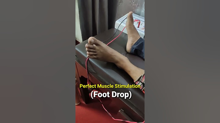 पैरों में लकवे का इलाज | How to apply Muscle stimulation in Foot Drop | Physio Dr Deepak Soni