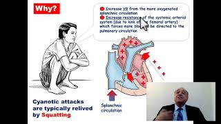 #usmle #internal_medicine #cme #medicaleducation #ecg #كورسات_باطنة #محاضرات_باطنة #medical