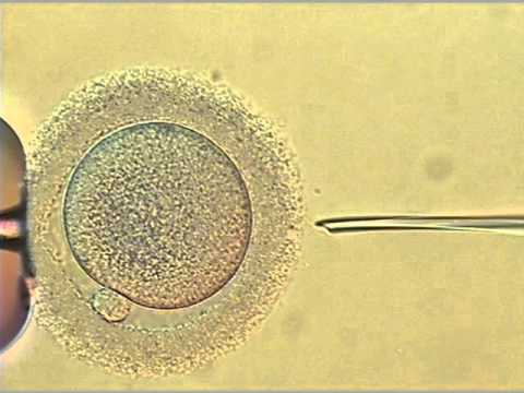 intracytoplasmic sperm injection of human egg